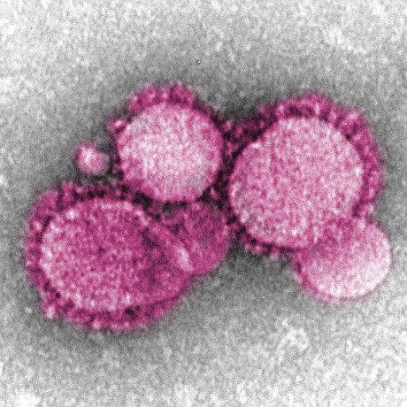 Novel Coronavirus nCoV by AJC1 is licensed under CC BY-SA 2.0 